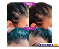 Happy Hair 03 Unidades - Vitamina Capilar Da Vrginia Fonseca